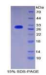 CD1D Protein - Recombinant Cluster Of Differentiation 1d By SDS-PAGE
