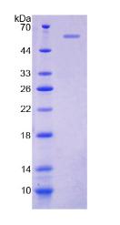 CD20 Protein - Recombinant Membrane Spanning 4 Domains Subfamily A, Member 1 By SDS-PAGE