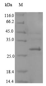 CD207 / Langerin Protein - (Tris-Glycine gel) Discontinuous SDS-PAGE (reduced) with 5% enrichment gel and 15% separation gel.