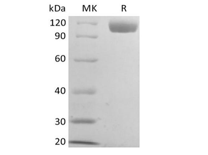 CD22 Protein - Recombinant Mouse B-cell Receptor CD22/Siglec-2/CD22 (C-6His)