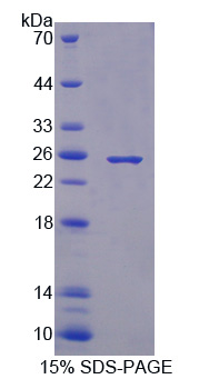 CD244 Protein - Recombinant Natural Killer Cell Receptor 2B4 By SDS-PAGE