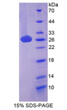 CD275 / B7-H2 / ICOS Ligand Protein - Recombinant Inducible T-Cell Co Stimulator Ligand By SDS-PAGE