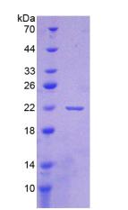 CD276 / B7-H3 Protein - Recombinant Cluster Of Differentiation 276 By SDS-PAGE