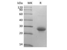 CD27L / CD70 Protein - Recombinant Mouse CD27 Ligand/TNFSF7/CD70 (N-10His)