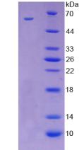 CD300LF / CD300f Protein - Recombinant Immune Receptor Expressed On Myeloid Cells 1 By SDS-PAGE