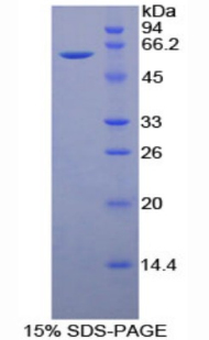 CD34 Protein - Recombinant Cluster Of Differentiation 34 By SDS-PAGE