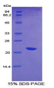 CD36 Protein - Recombinant Platelet Membrane Glycoprotein IV By SDS-PAGE