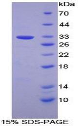 CD38 Protein - Recombinant Cyclic ADP Ribose Hydrolase By SDS-PAGE