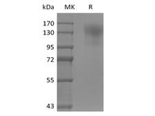CD45 / LCA Protein - Recombinant Mouse CD45/PTPRC (C-6His)