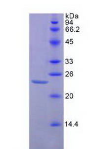 CD47 Protein - Recombinant Integrin Associated Protein By SDS-PAGE