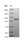 CD63 Protein - (Tris-Glycine gel) Discontinuous SDS-PAGE (reduced) with 5% enrichment gel and 15% separation gel.