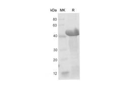 CD66a / CEACAM1 Protein - Recombinant Mouse Ceacam1/BGP-1 protein (His Tag)