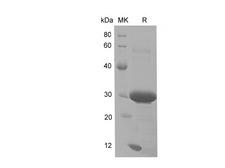 CD74 / CLIP Protein - Recombinant Mouse CD74 protein (His Tag)