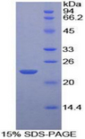 CD79A / CD79 Alpha Protein - Recombinant Immunoglobulin Associated Alpha By SDS-PAGE