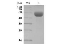 CD79B / CD79 Beta Protein - Recombinant Mouse CD79B/B29 (C-Fc)