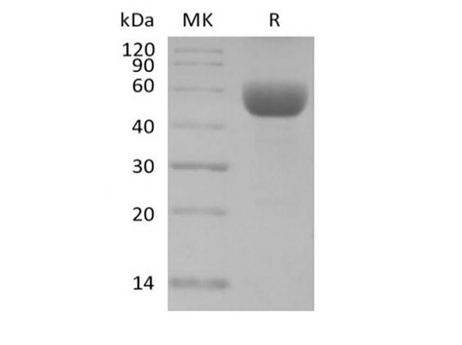 CD79B / CD79 Beta Protein - Recombinant Mouse CD79B/B29 (C-Fc)