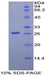 CD79B / CD79 Beta Protein - Recombinant Immunoglobulin Associated Beta By SDS-PAGE