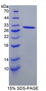 CD84 / SLAMF5 Protein - Recombinant  Signaling Lymphocytic Activation Molecule Family, Member 5 By SDS-PAGE