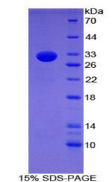CD86 Protein - Recombinant B-Lymphocyte Activation Antigen B7-2 By SDS-PAGE