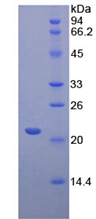CD8B / CD8 Beta Protein - Recombinant Cluster Of Differentiation 8b By SDS-PAGE
