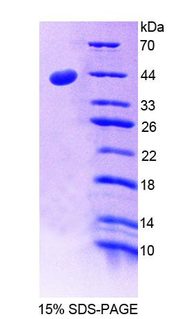 CD99 Protein - Recombinant Cluster Of Differentiation 99 By SDS-PAGE