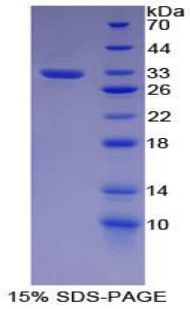 CDH16 / Cadherin 16 Protein - Recombinant Cadherin 16 By SDS-PAGE