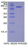 CDH3 / P-Cadherin Protein - Recombinant Cadherin, Placental By SDS-PAGE