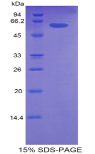 CDK2 Protein - Recombinant Cyclin Dependent Kinase 2 By SDS-PAGE