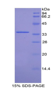 CDK4 Protein - Recombinant Cyclin Dependent Kinase 4 By SDS-PAGE