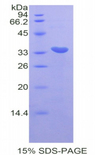 CDK7 Protein - Recombinant Cyclin Dependent Kinase 7 By SDS-PAGE