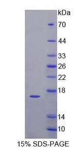 CDKN2B / p15 INK4b Protein - Recombinant Cyclin Dependent Kinase Inhibitor 2B (CDKN2B) by SDS-PAGE