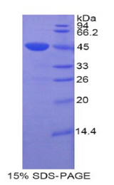 CDNF / ARMETL1 Protein - Recombinant Cerebral Dopamine Neurotrophic Factor By SDS-PAGE