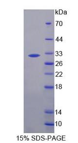 CELA2A / ELA2A Protein - Recombinant  Elastase 2A By SDS-PAGE