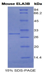 CELA3B / ELA3B Protein - Recombinant Elastase 3B By SDS-PAGE