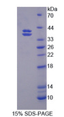 CELSR2 Protein - Recombinant Cadherin EGF LAG Seven Pass G-Type Receptor 2 By SDS-PAGE
