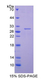 CENPH / CENP-H Protein - Recombinant Centromere Protein H By SDS-PAGE