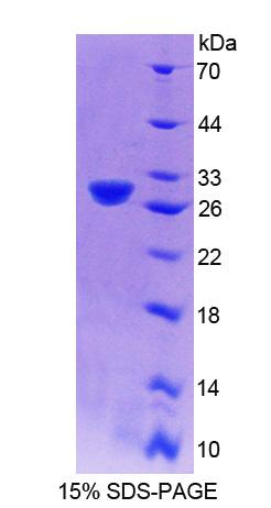 CENPJ / LAP Protein - Recombinant Centromere Protein J By SDS-PAGE