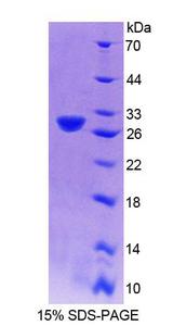 CENPJ / LAP Protein - Recombinant Centromere Protein J By SDS-PAGE