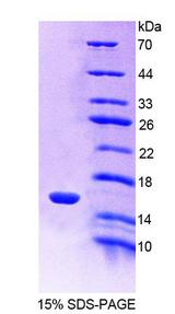 CFB / Complement Factor B Protein - Recombinant Complement Factor B By SDS-PAGE