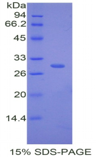 CFD / Factor D / Adipsin Protein - Recombinant Complement Factor D By SDS-PAGE