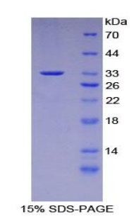 CFLAR / FLIP Protein - Recombinant CASP8 And FADD Like Apoptosis Regulator By SDS-PAGE