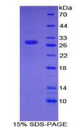 CHD3 Protein - Recombinant Chromodomain Helicase DNA Binding Protein 3 By SDS-PAGE
