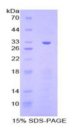 CHEK1 / CHK1 Protein - Recombinant Checkpoint Homolog By SDS-PAGE
