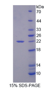 CHGA / Chromogranin A Protein - Recombinant Chromogranin A By SDS-PAGE