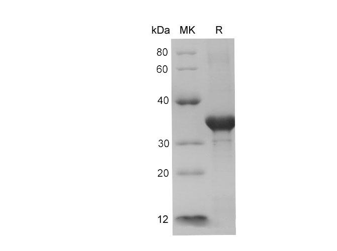 CHGA / Chromogranin A Protein - Recombinant Mouse Chromogranin-A/Chga protein (His Tag)