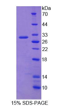 CHGB / Chromogranin B Protein - Recombinant Chromogranin B (CHGB) by SDS-PAGE
