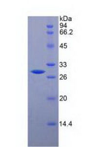 CHI3L1 / YKL-40 Protein - Recombinant Glycoprotein 39, Cartilage By SDS-PAGE