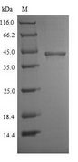 CHID1 Protein - (Tris-Glycine gel) Discontinuous SDS-PAGE (reduced) with 5% enrichment gel and 15% separation gel.