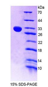 CHIT1 / Chitotriosidase Protein - Recombinant  Chitinase 1 By SDS-PAGE