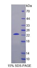 CHKB / CHKL Protein - Recombinant Choline Kinase Beta (CHKb) by SDS-PAGE